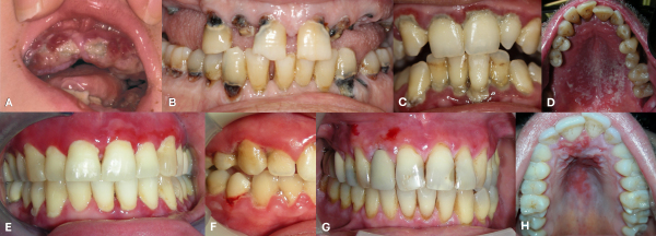 An external file that holds a picture, illustration, etc., usually as some form of binary object. The name of referred object is rmmj-17-1-e0007_g001.gif
